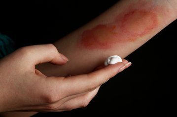 Kopie von Heilpflanzen Erkältung